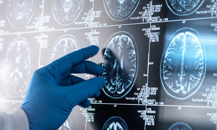 UT San Antonio joins nine institutions to accelerate Alzheimer’s research with massive data network