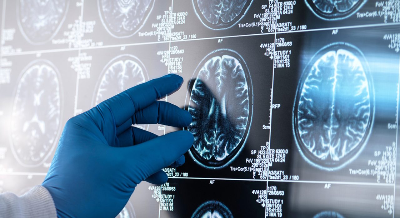 brain scans
