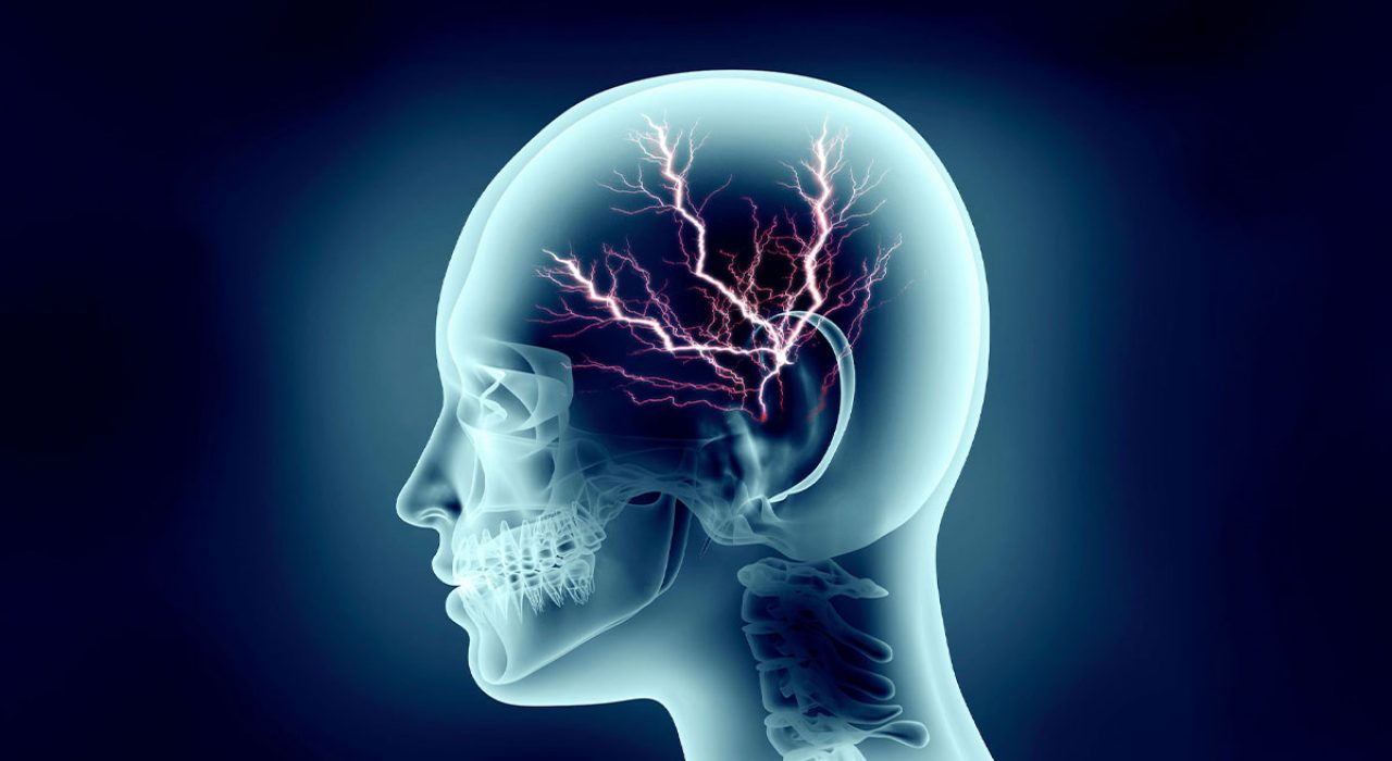 Neuronal-imaging