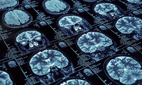 Researchers launch nationally recognized Center on Alzheimer’s and Aging