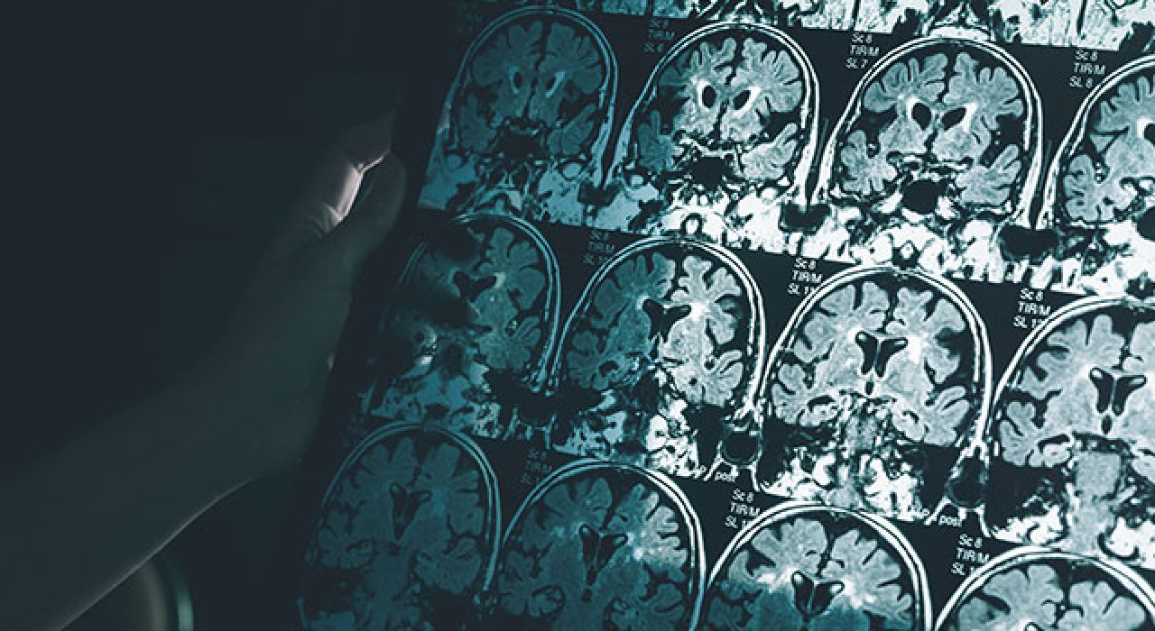 Oskar Fischer was a Jewish pioneer in neuroscience who studied dementia more than 112 years ago.