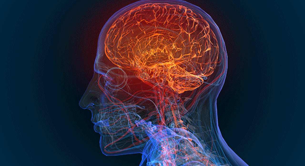 brain-health_780