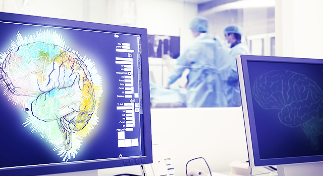 brain-research_780
