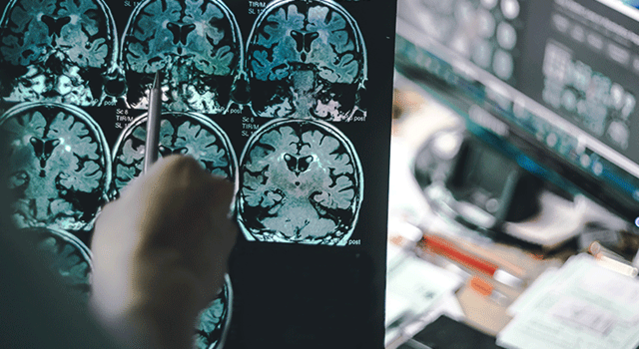 neuroscience_780