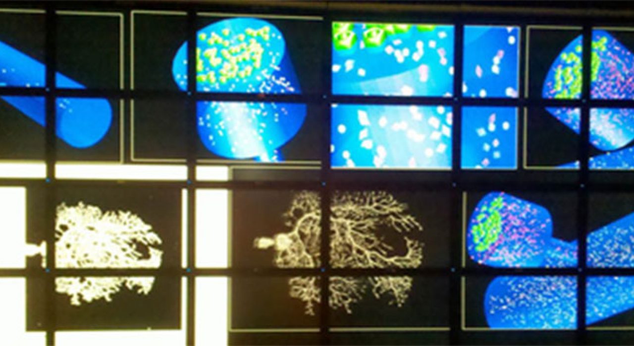 Images of the cells Fidel Santamaria works on in his UTSA lab.